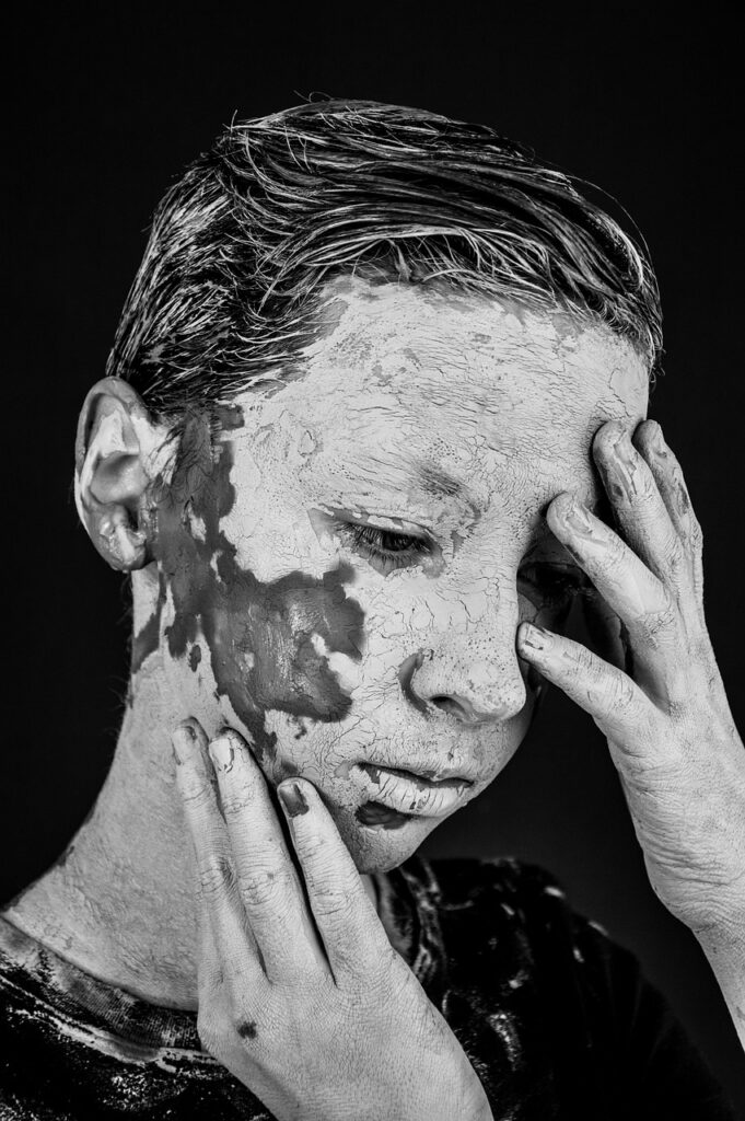 無印良品のニキビ跡に効果的な色素沈着対策のローションおすすめは？